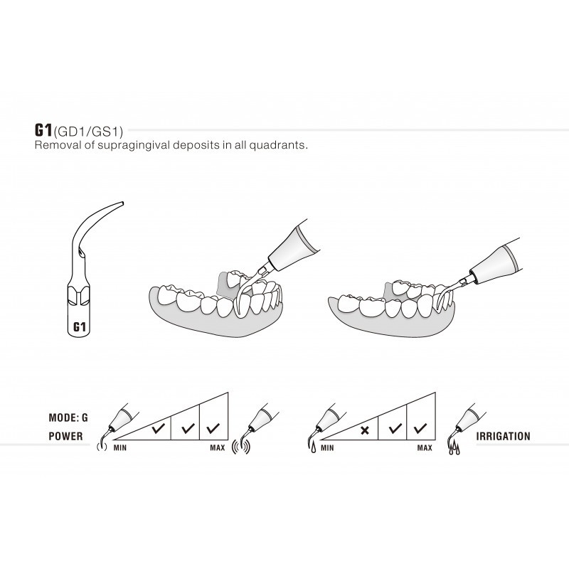 Insert G1 compatible EMS