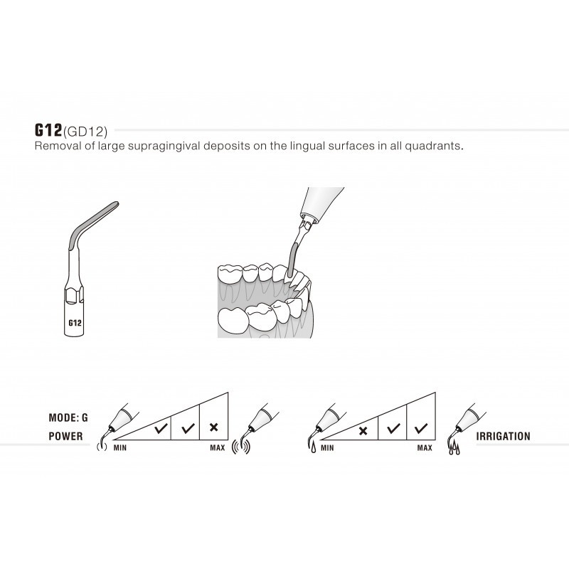 Insert G2 compatible EMS