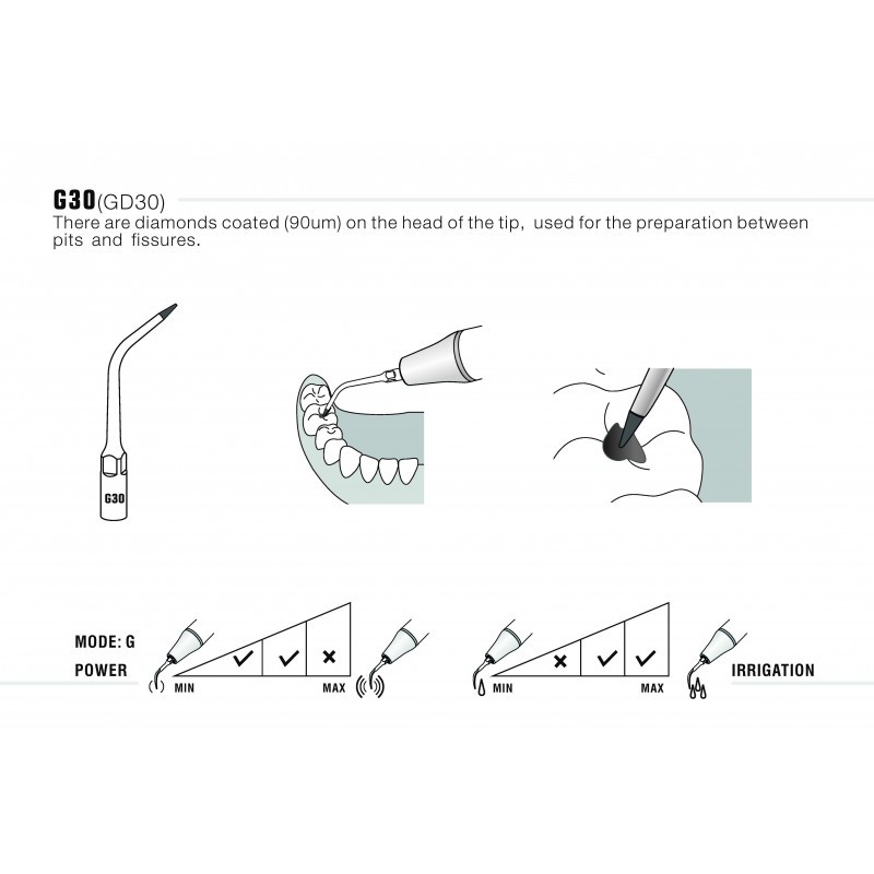 Insert G30 compatible EMS