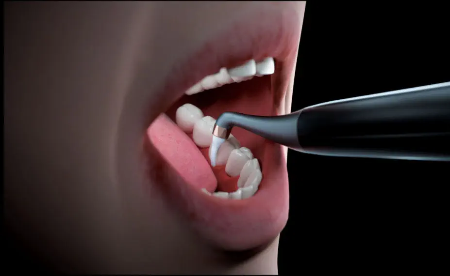 Aéropolisseur AP-H Plus compatible
KAVO/MULTIFLEX